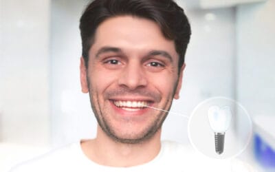 ابتسامتك أحلى مع زراعة الأسنان